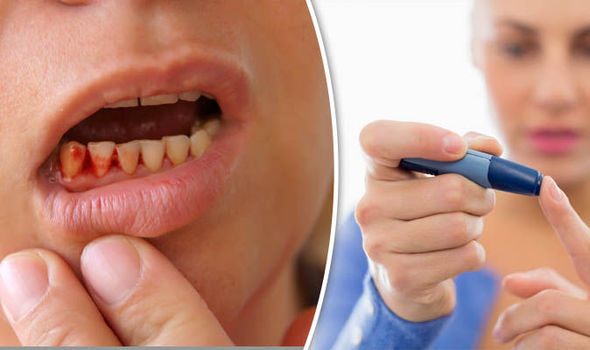 Gum Disease & Diabetes Symptoms